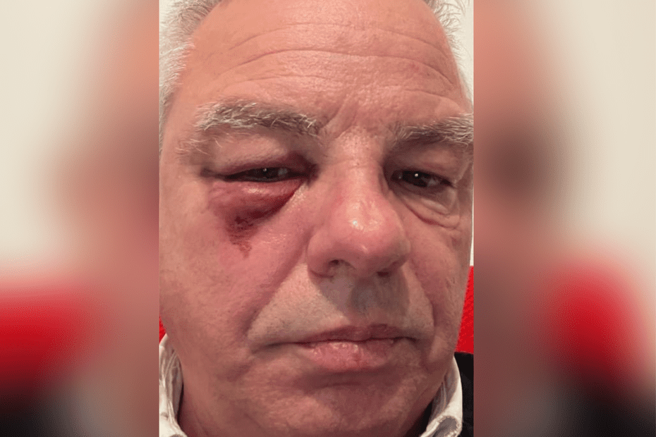 "Odieux", "inadmissible" : vives réactions après l'agression d'un maire de l'Isère par des individus se revendiquant d'extrême droite