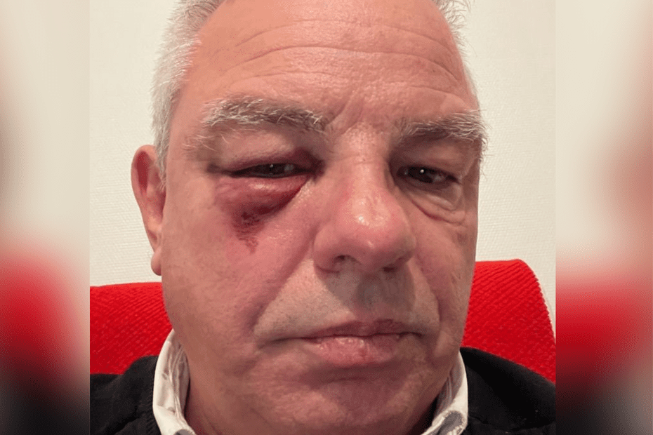 "On a senti qu'on était en danger" : le maire de l'Isère, agressé par des personnes se revendiquant d'extrême droite, raconte les violences